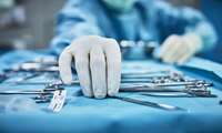 جراحی موفقیت‌آمیز خارج کردن توده از رگ پشت کبد یک زن 47 ساله توسط متخصصان بیمارستان  آیت الله طالقانی